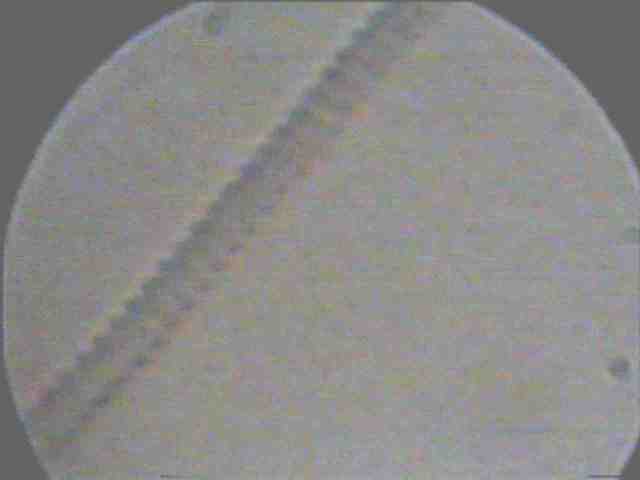 Cyanobacteria under microscope